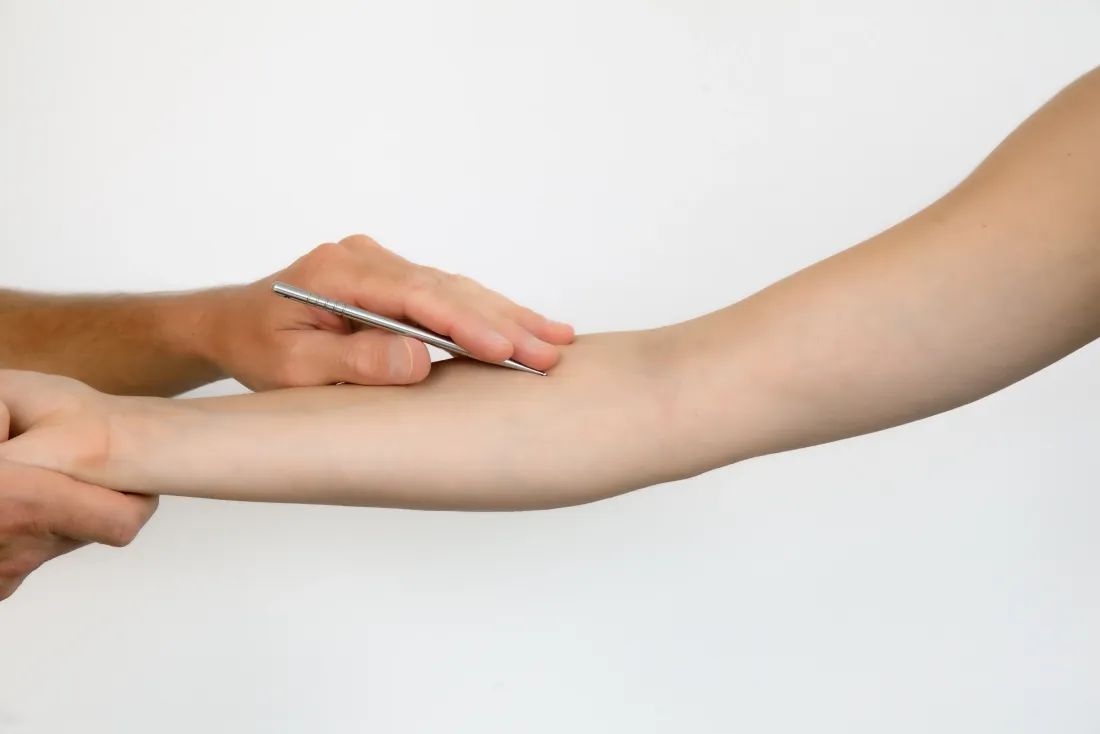 APM-Behandlung am Arm: Stimulation der Meridiane mit dem Therapiestäbchen